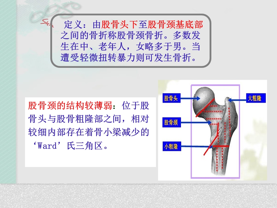 髋关节置换术后护理.ppt_第2页