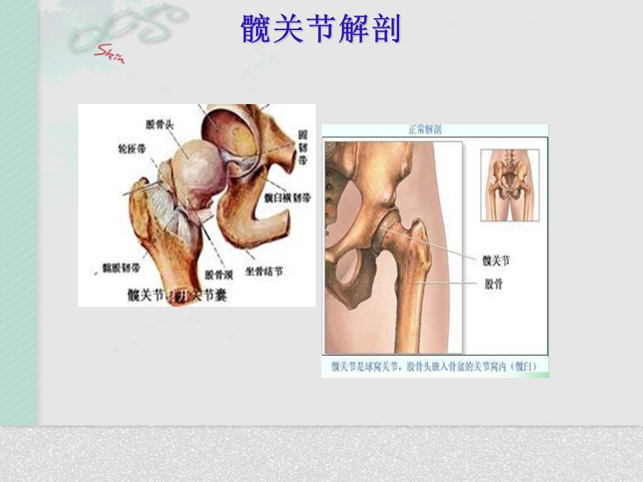 髋关节置换术后护理.ppt_第3页