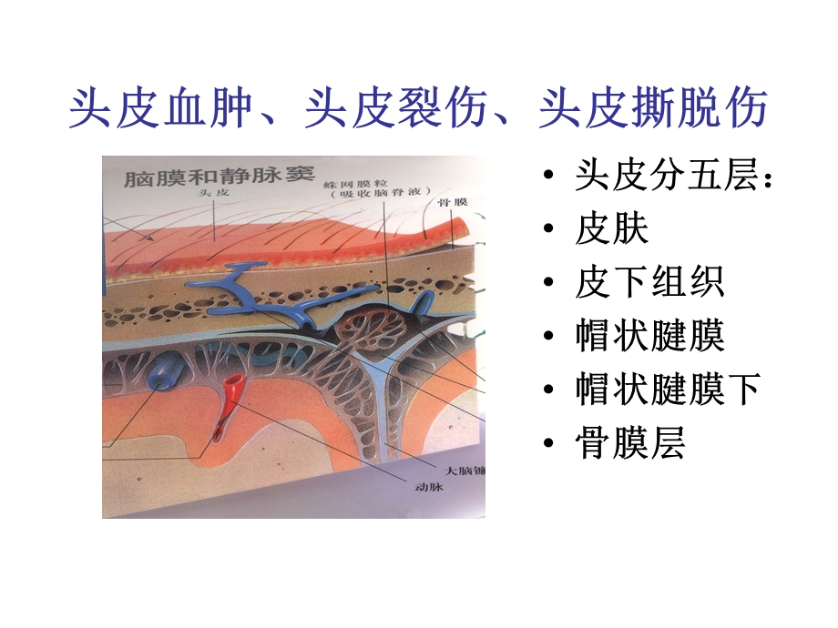 颅脑损伤病人的护3.ppt_第3页