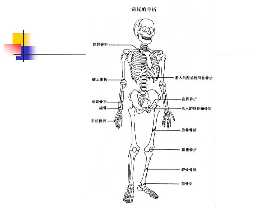 骨与关节损伤病人的护理.ppt_第2页