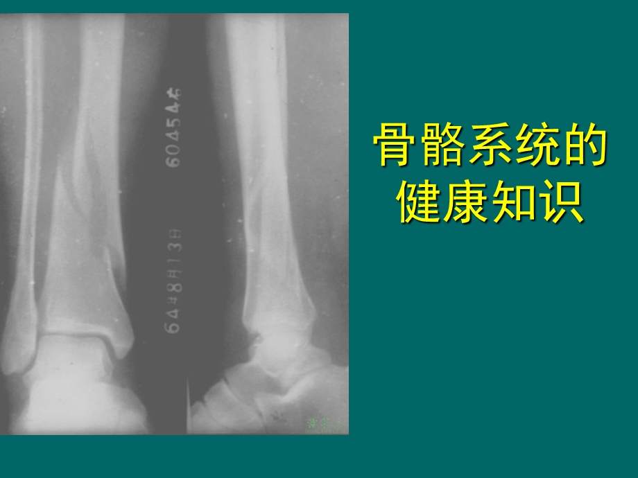 骨骼系统健康知识J.ppt_第1页