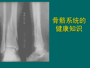 骨骼系统健康知识J.ppt