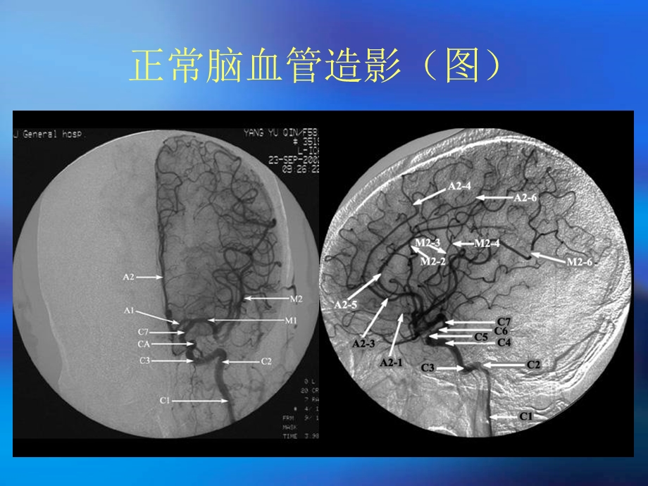 颅骨x线诊断.ppt_第2页