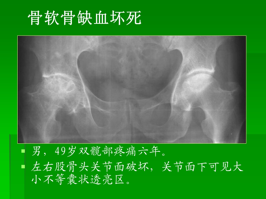 骨与关节3new.ppt_第3页