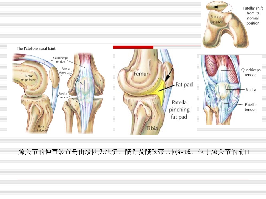 髌骨骨折康复.ppt_第2页