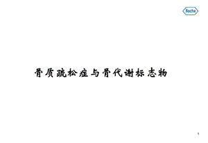 骨代谢标志物与骨质疏松症1104全军检验会.ppt