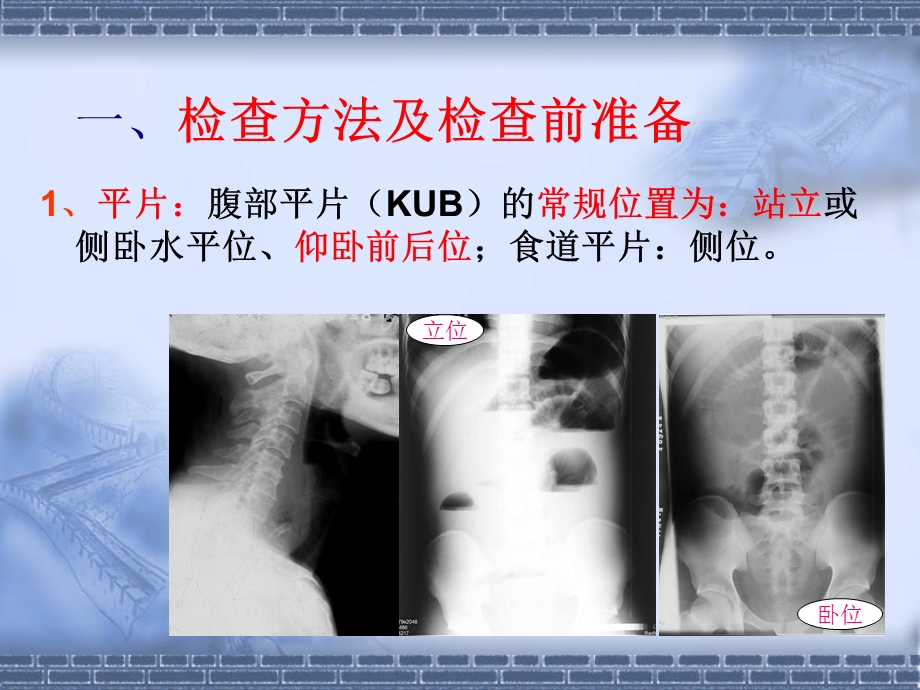 消化道的常用检查.ppt_第3页