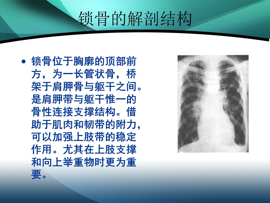 锁骨骨折的护理课件.ppt_第2页