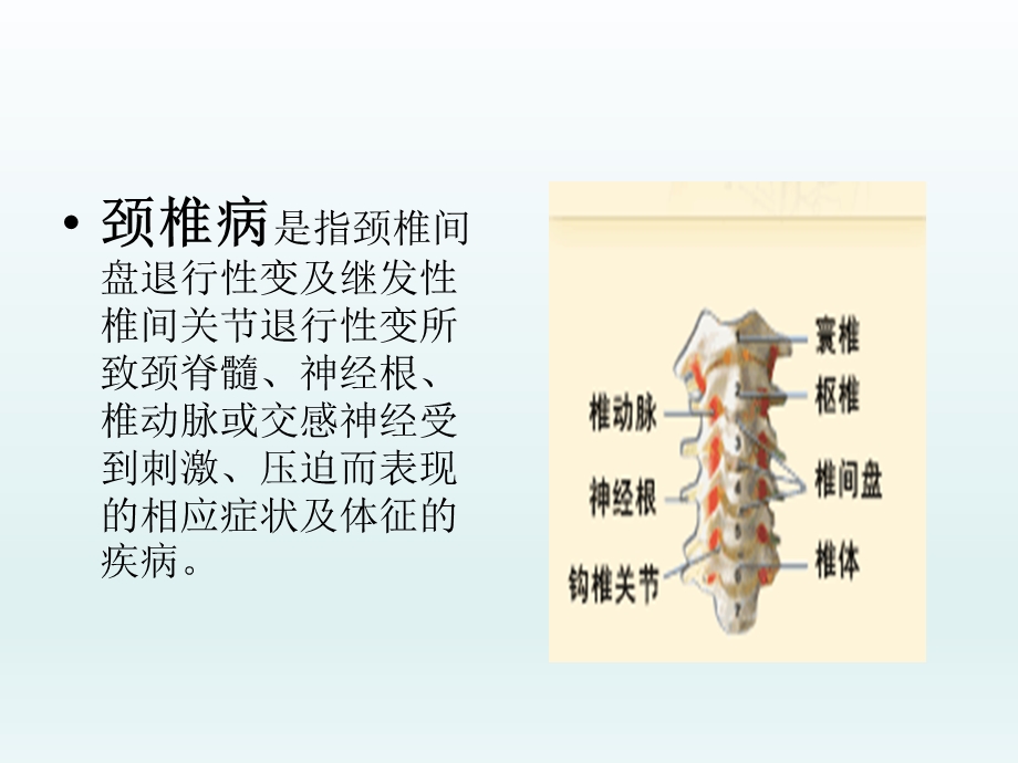 颈椎病的预防及治疗.ppt_第2页