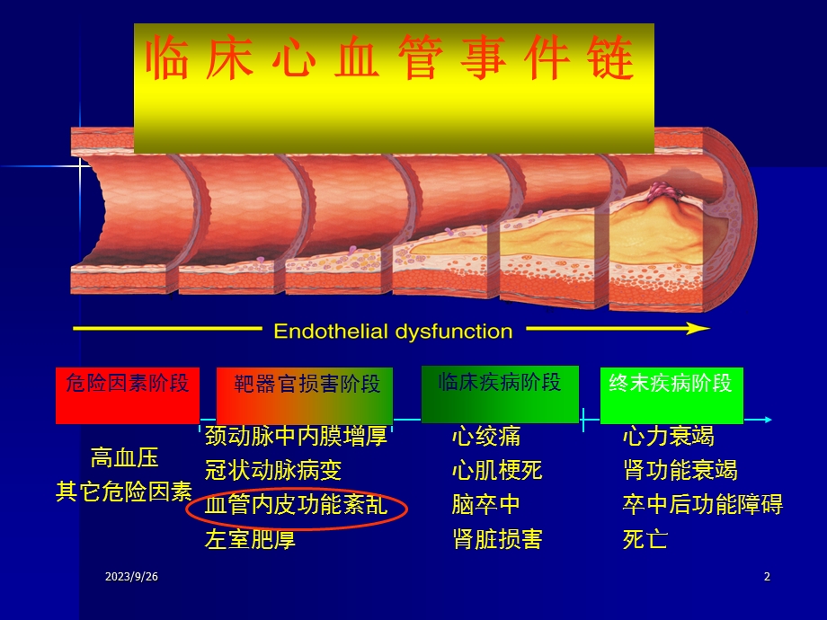 顽固性高血压.ppt_第2页