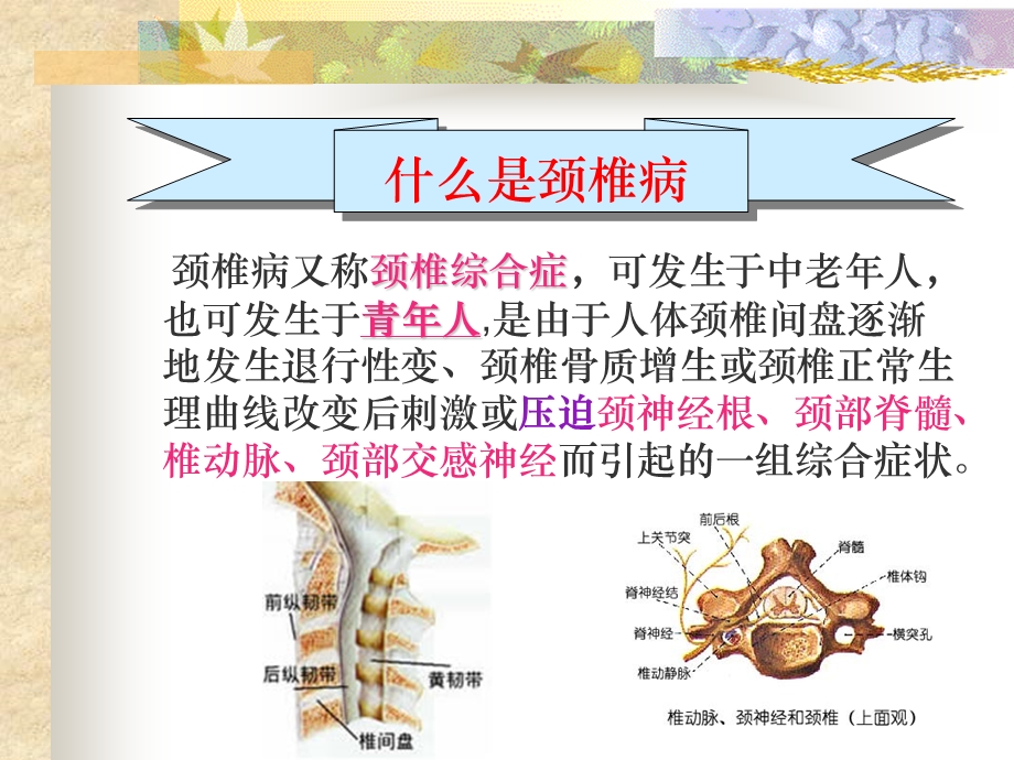 颈椎病的预防.ppt_第2页