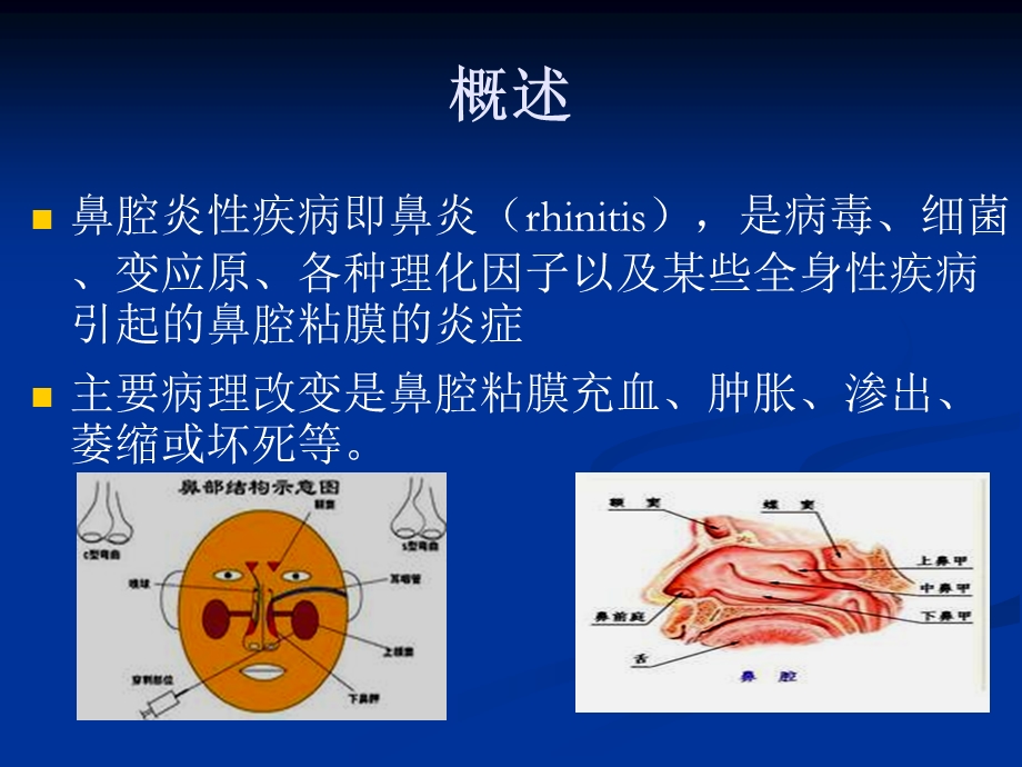 鼻腔炎性疾病.ppt_第2页