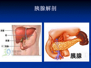 高脂血症性胰腺炎图文.ppt