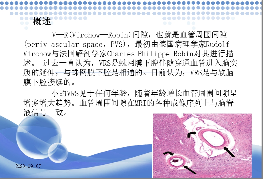 vr间隙mr成像表现ppt课件.ppt_第2页