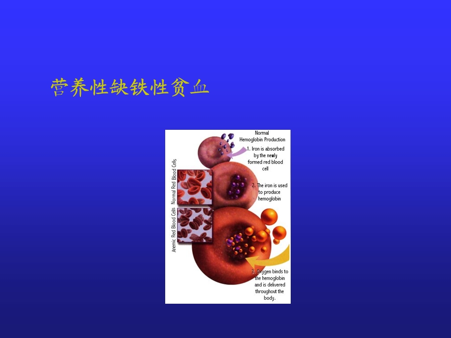 缺铁贫血影像培训课件.ppt_第2页