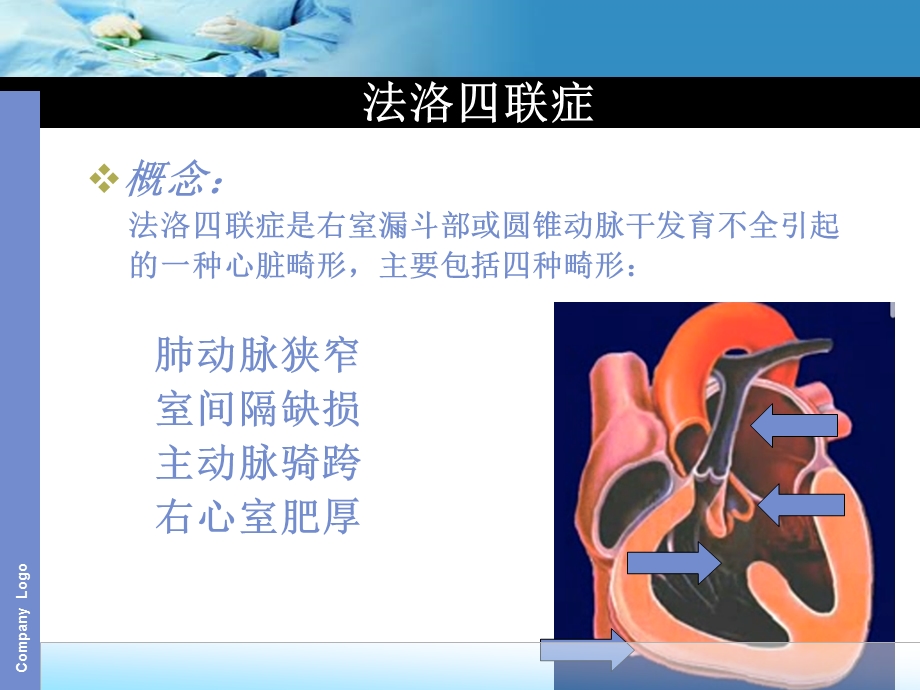 tof法洛四联症ppt课件.ppt_第2页