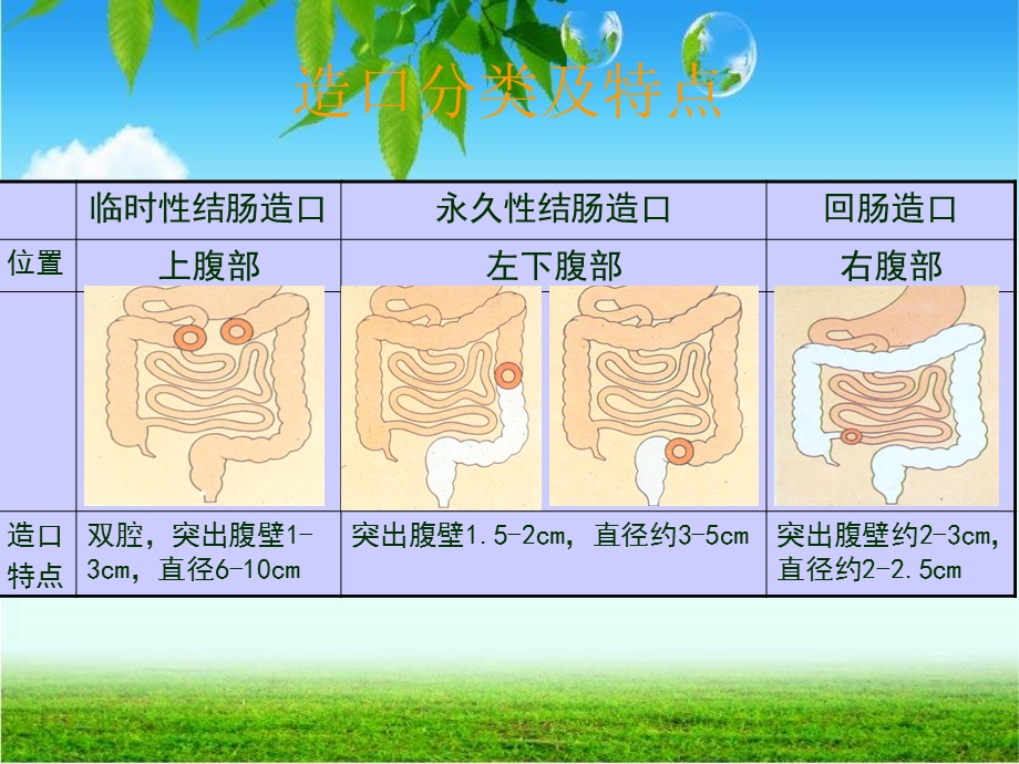 肠造口护理9wppt课件.ppt_第2页