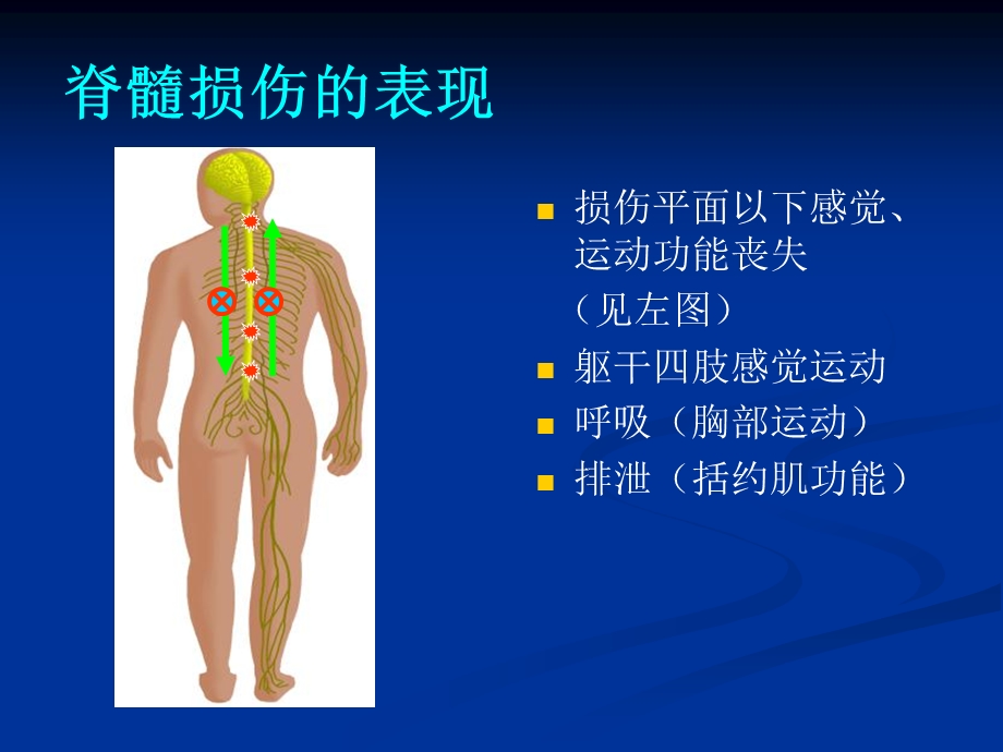 脊柱脊髓损伤的临.ppt_第3页