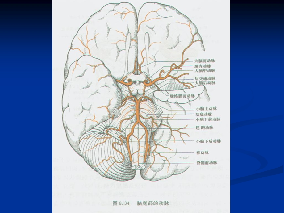 脑血管疾病06071.ppt_第3页