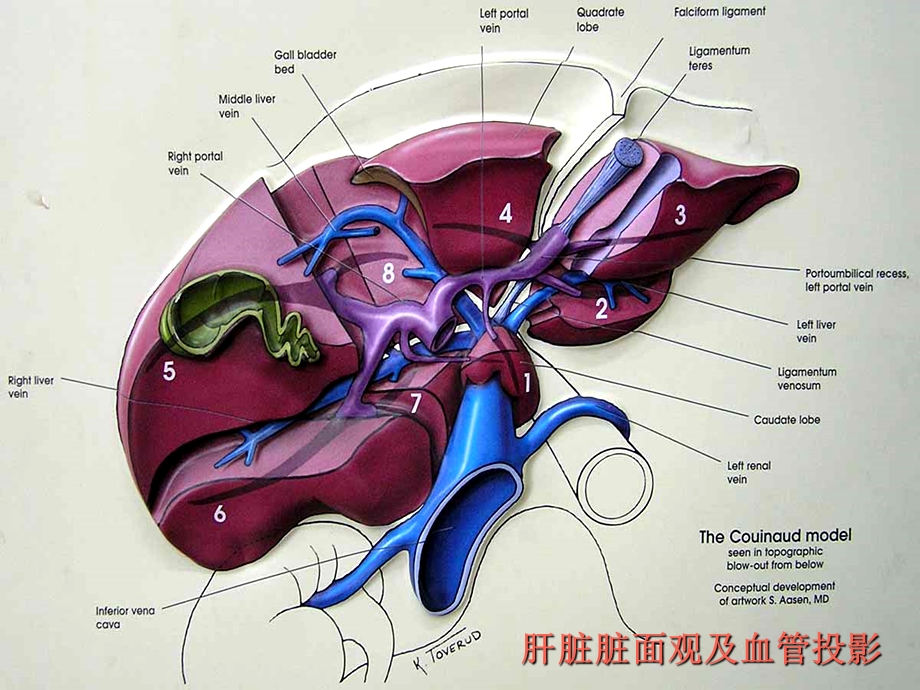 肝脏8段分法的影像学.ppt_第3页