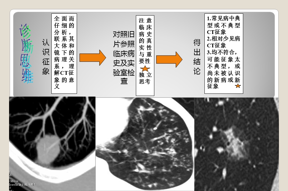 肺特殊CT征象.ppt_第3页