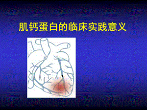 肌钙蛋白的临床实践意义.ppt