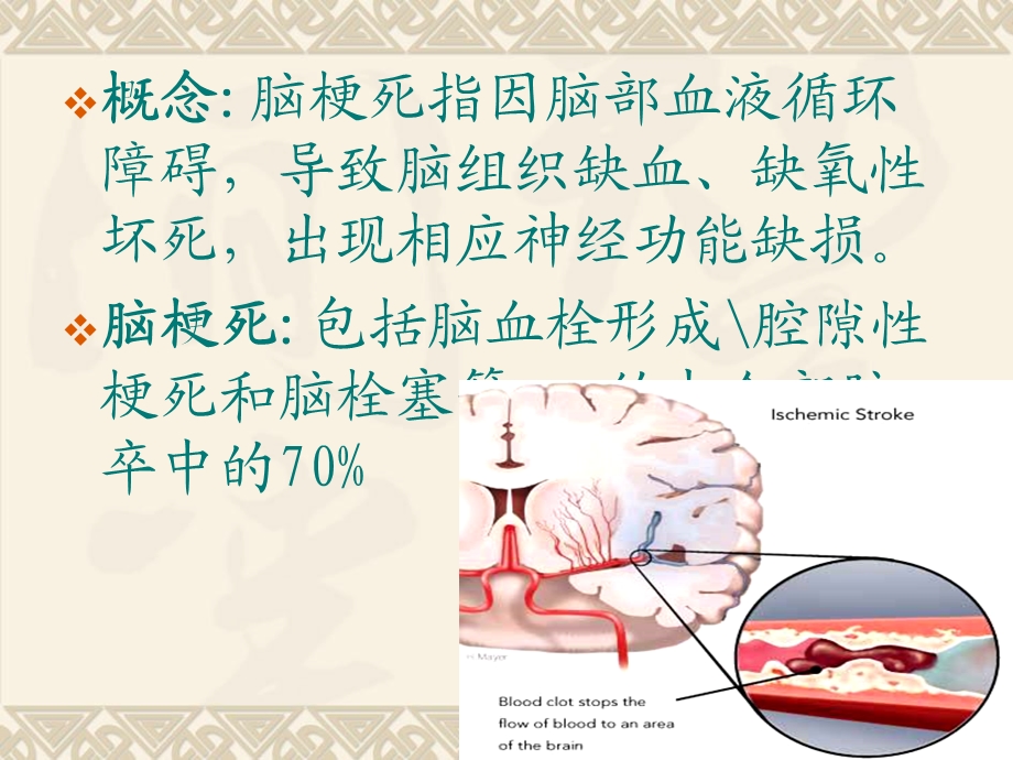 脑梗死诊断影像学治疗.ppt_第2页