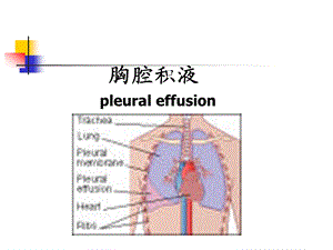 胸腔积液课件.ppt