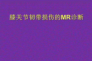 膝关节韧带损伤的MR诊断.ppt