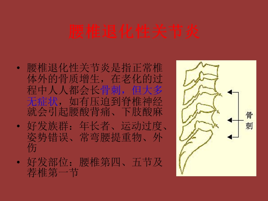 腰背问题探究和保健.ppt_第3页