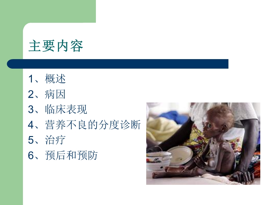 蛋白质能量营养不良.ppt_第2页