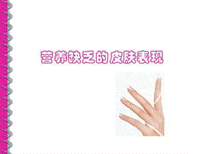 营养缺乏的皮肤表现090804.ppt