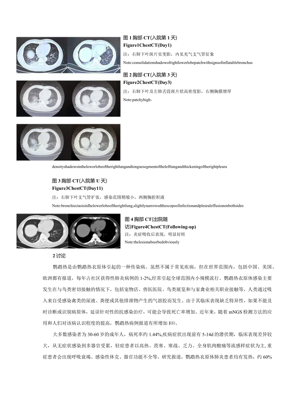 鹦鹉热衣原体引起重症肺炎一例报道及文献复习.docx_第3页