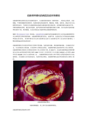 动脉粥样硬化的病因及症状有哪些.docx