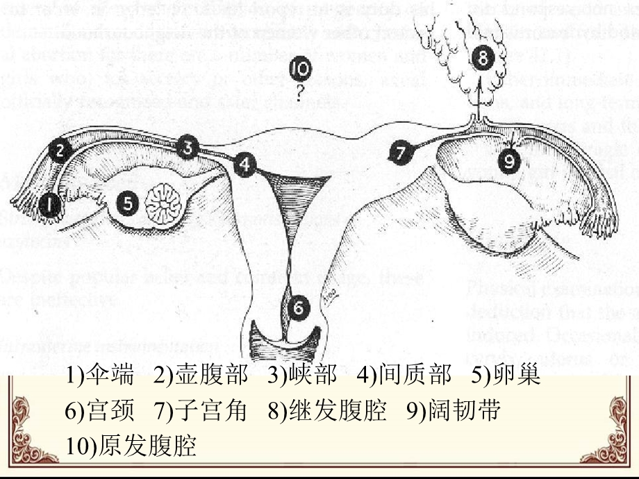 宫外孕护理大查房.ppt_第3页