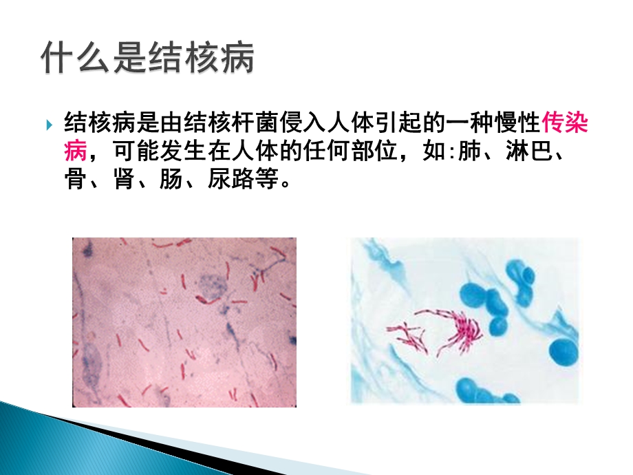 学校结核病防控知识.ppt_第3页