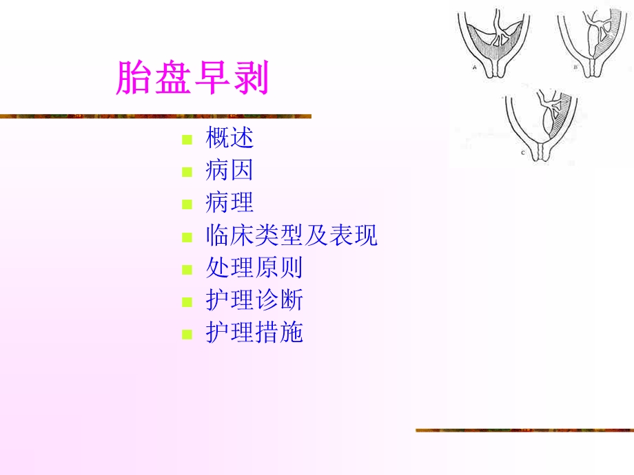 胎盘早剥的护理.ppt_第2页