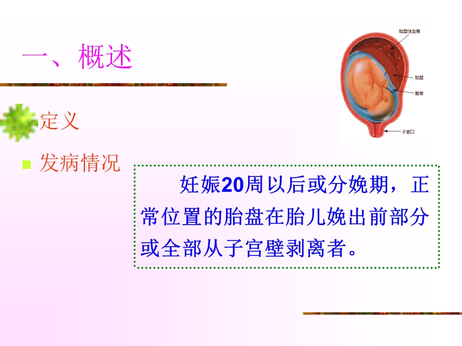 胎盘早剥的护理.ppt_第3页