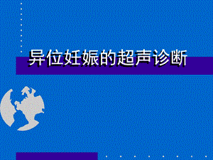 异位妊娠的超声诊断.ppt.ppt