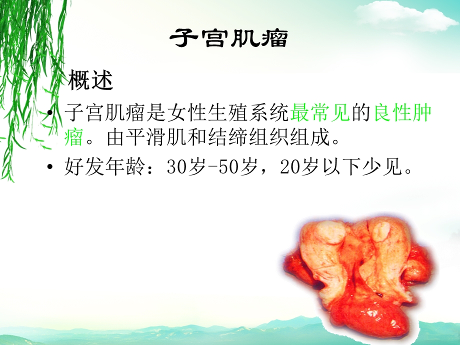 疾病查房—子宫肌瘤的护理1.ppt_第3页