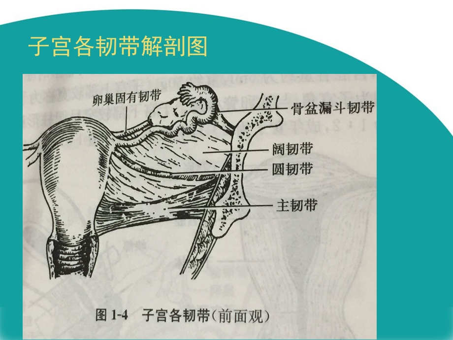 腹腔镜下全子宫切除术.ppt_第3页