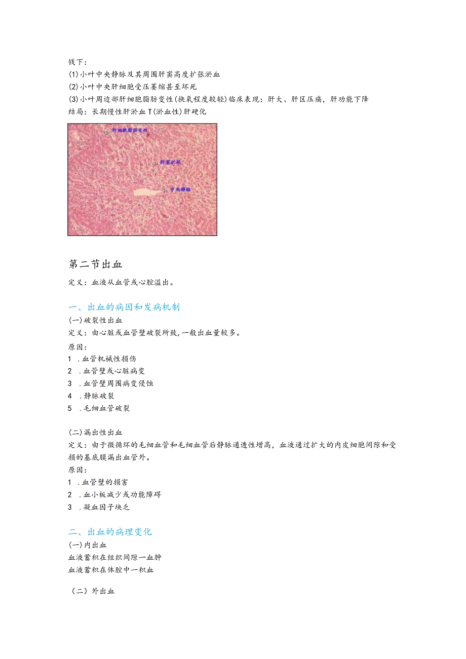 病理学整理3.局部血液循环障碍.docx_第3页