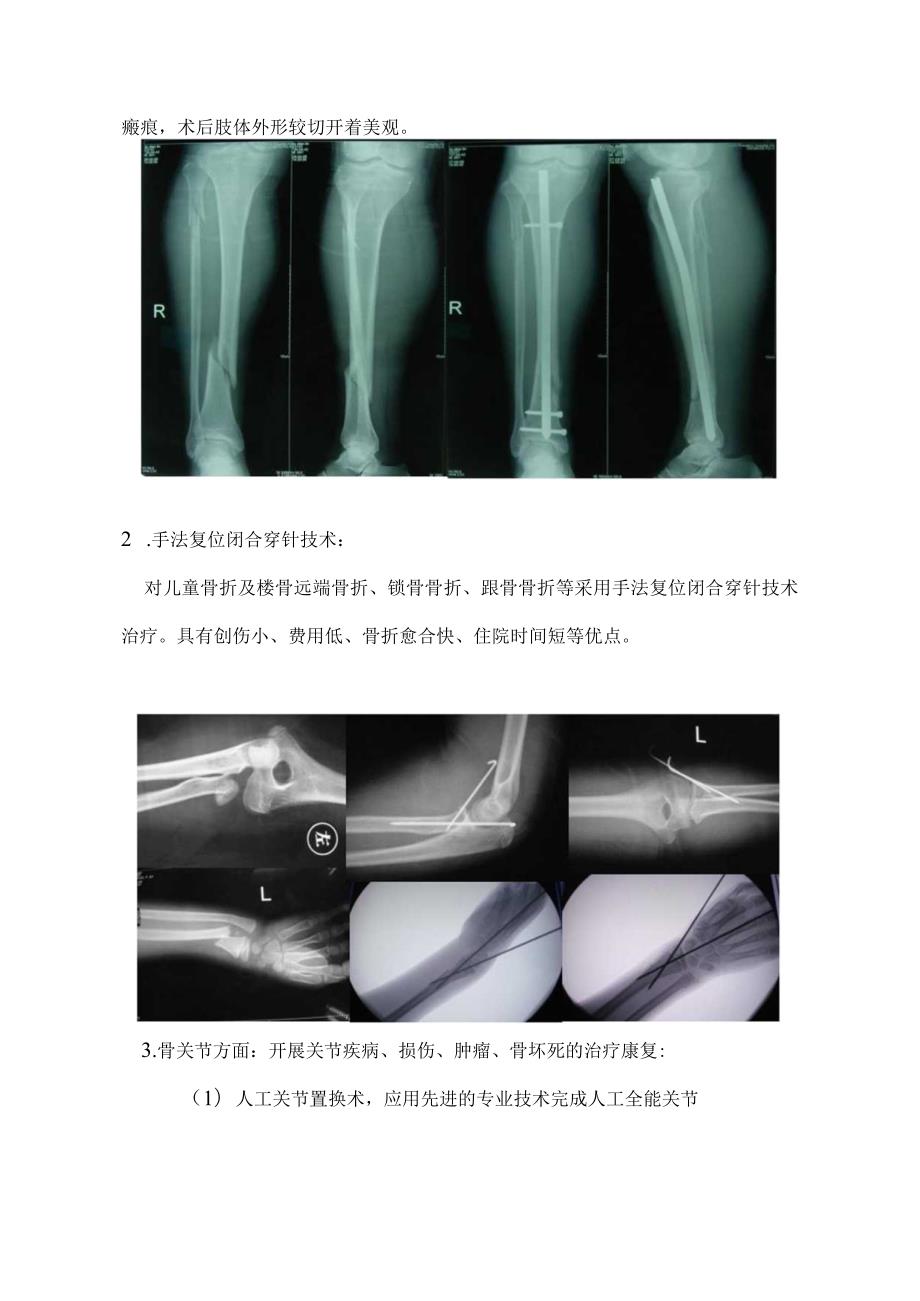 骨外科科室简介.docx_第3页