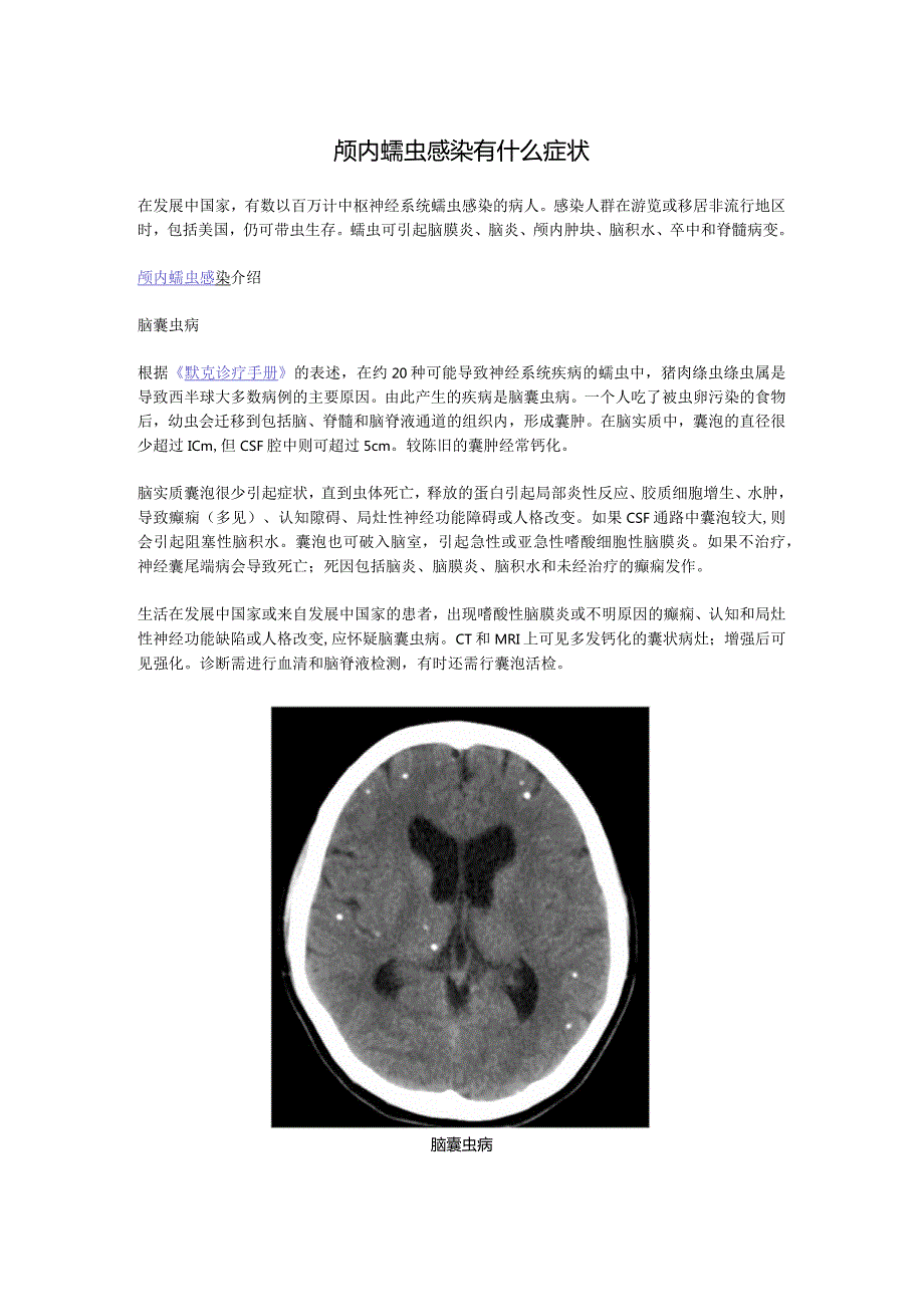 颅内蠕虫感染有什么症状.docx_第1页