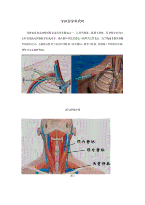 深静脉穿刺全攻略-深静脉穿刺全攻略.docx