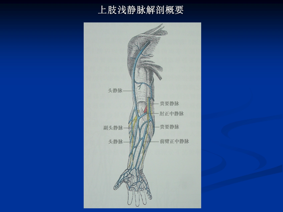 【精品】彩色多普勒超声在上肢浅静脉置管术中的应用.ppt_第2页