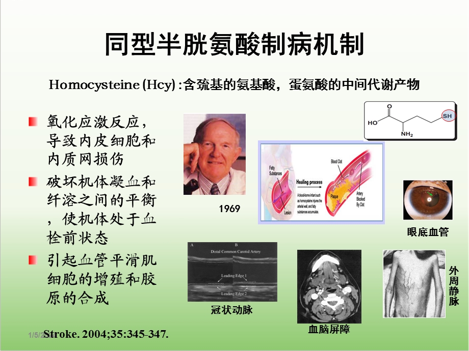 H型高血压防治措施医学幻灯片.ppt_第2页