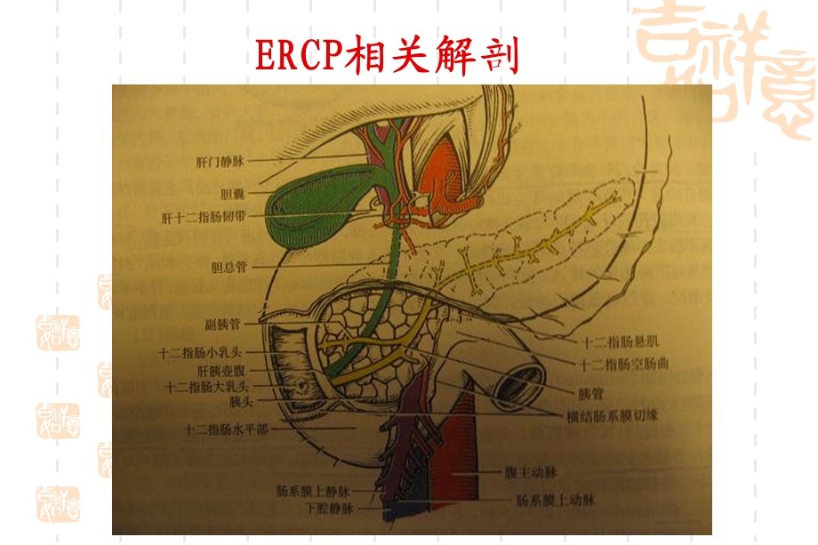 ERCP业务学习.ppt_第3页