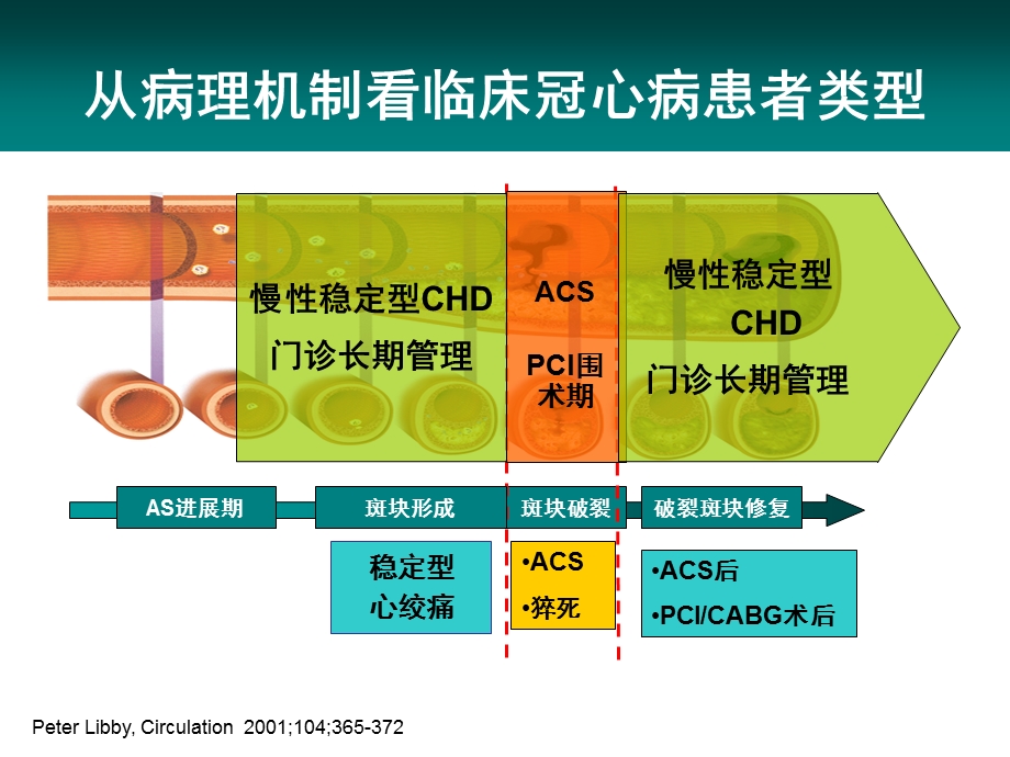 冠心病他汀优化治疗策略.ppt_第2页