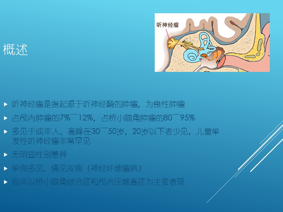 听神经瘤诊断.ppt_第3页